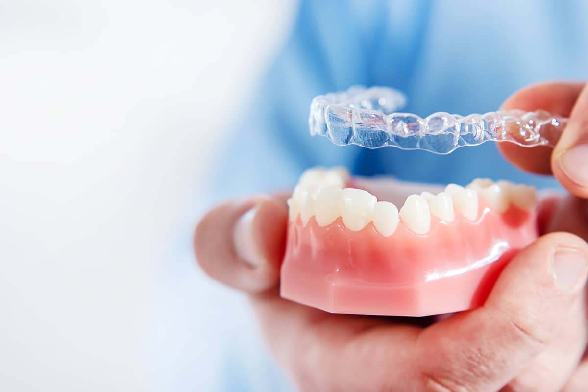 How long does invisalign treatment take for adults in andover blog