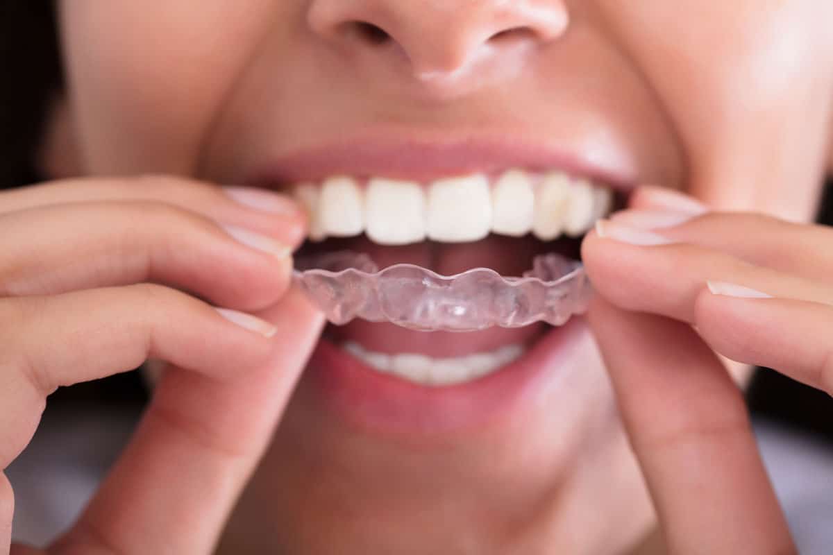 Person Putting In Clear Retainer.jpg