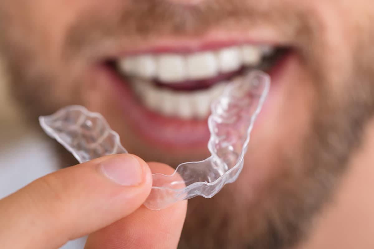 The pros and cons of using invisalign for your treatment blog