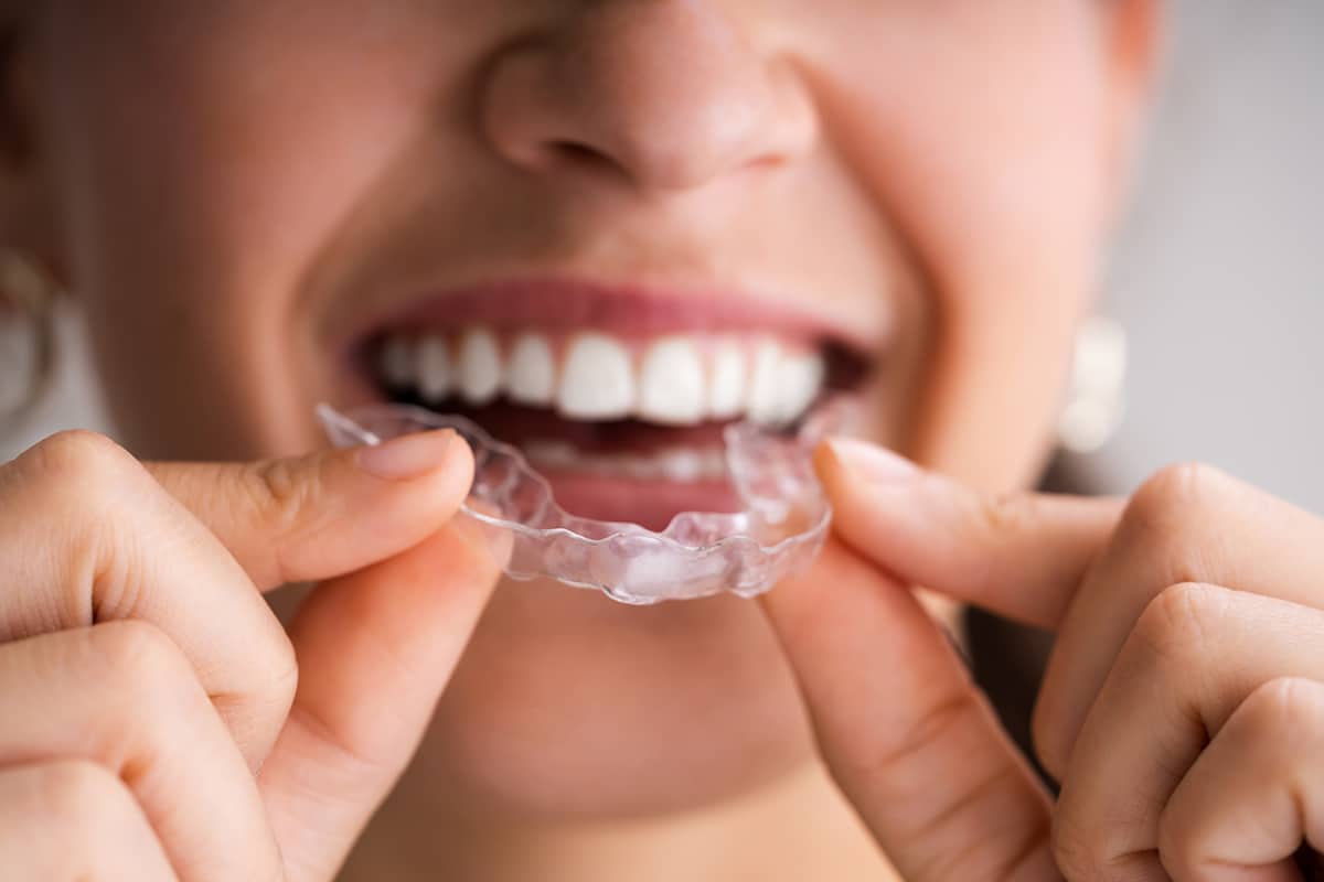 What are the benefits of invisalign teen over traditional braces blog