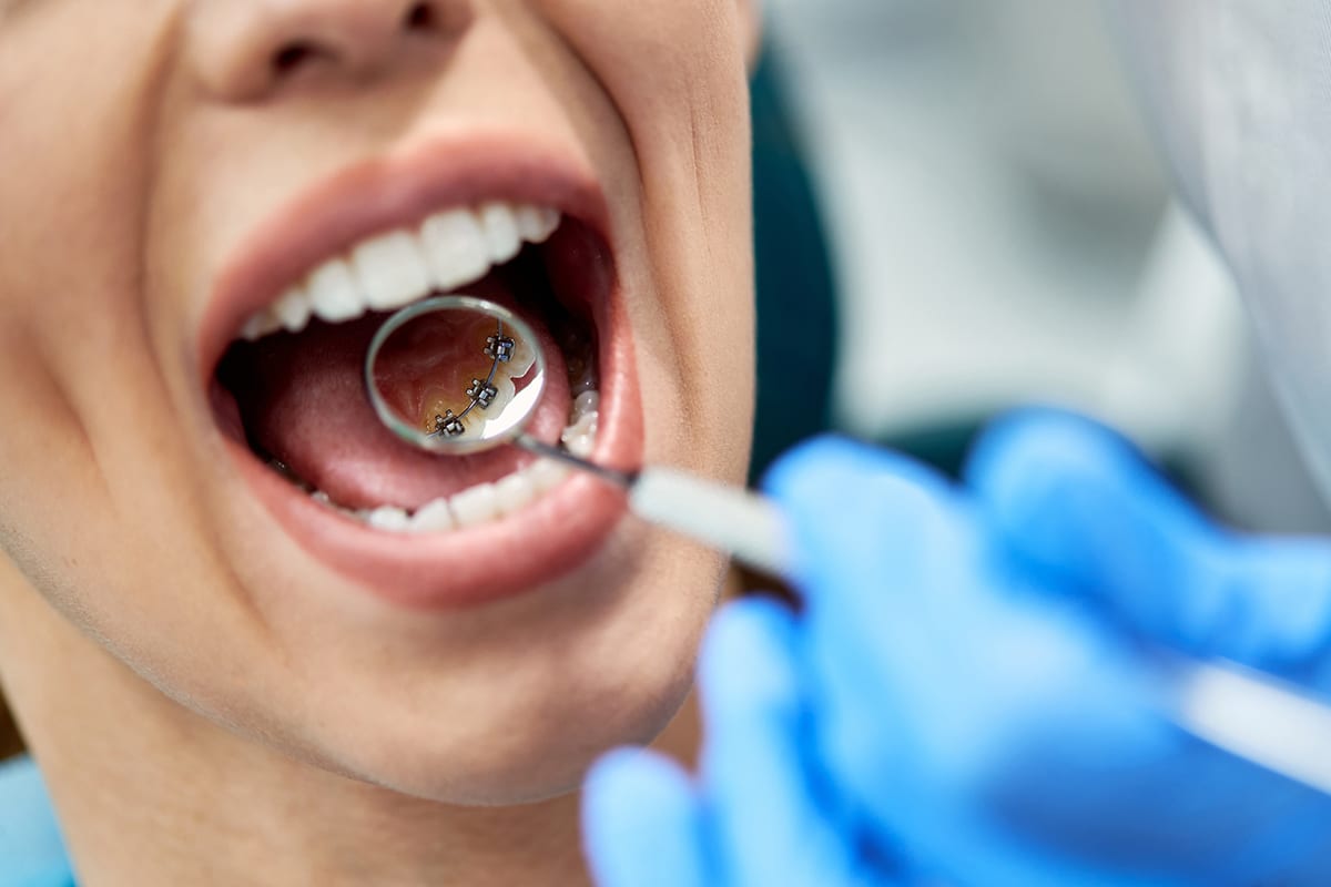 What to expect during your first orthodontic appointment in andover blog