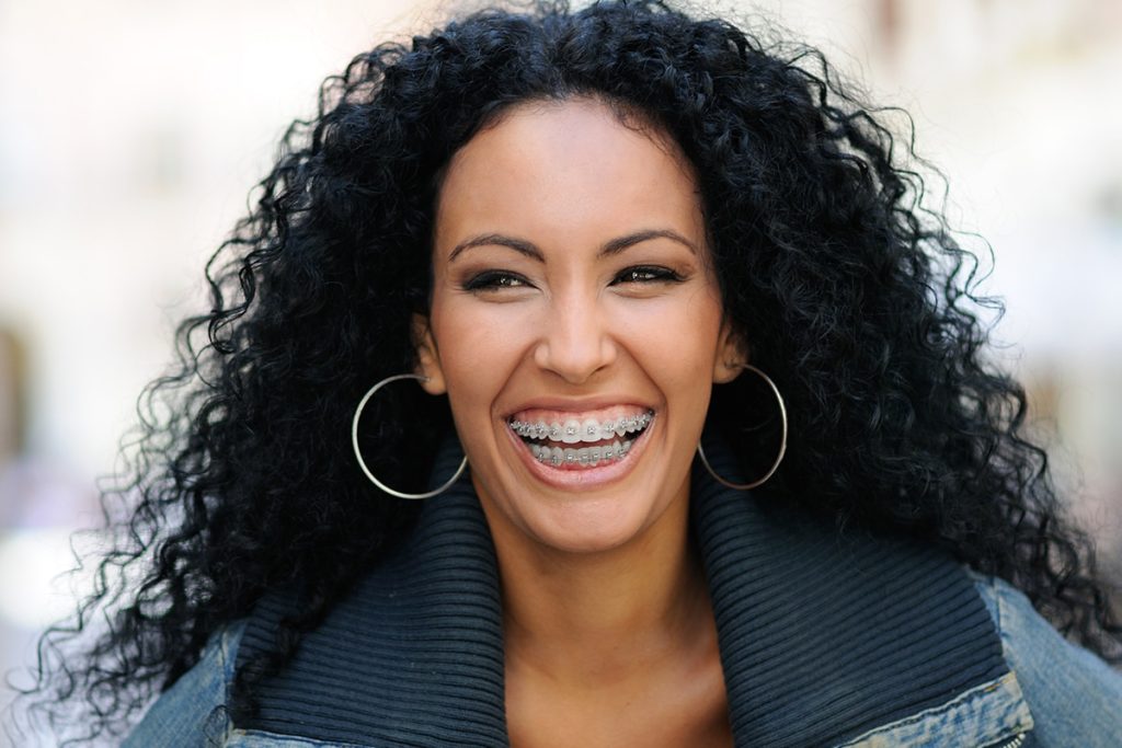 What You Can and Can't Eat With Braces? Andover Orthodontics Anthony